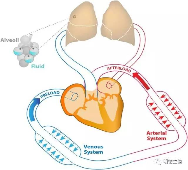 心力衰竭：心臟病患者的頭號殺手